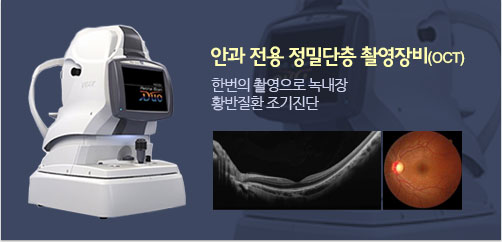 안과 전용 정밀단층 촬영장비(OCT)